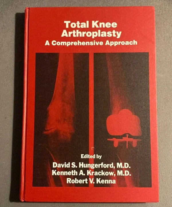 Total Knee Arthroplasty
