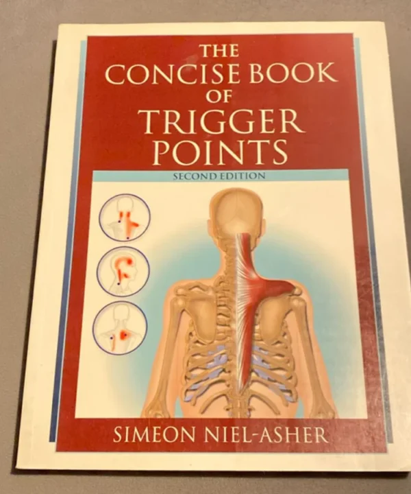 The Concise Book Of Trigger Points, Revised Edition