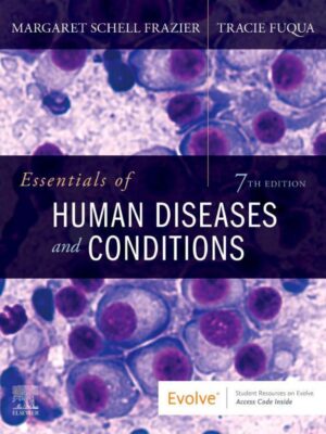 Essentials of Human Diseases and Conditions 7th Edition